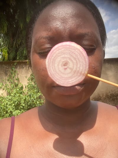 An outdoor, close-up, and slightly overhead shot features a person with dark skin, seen from the upper chest to the top of the head, against a bright background. The person's eyes are closed. A circular slice of red onion is positioned directly in front of their mouth and nose area, held in place by a thin wooden skewer or stick that extends upwards from behind the onion.
The scene is brightly lit by direct sunlight, casting strong shadows on the person's skin, particularly on their right shoulder and chest. The person appears to be wearing a dark reddish or maroon strap, possibly from a top or swimwear, visible on the lower right.
The background on the left side shows a clear blue sky with some white clouds. On the lower right and bottom, green foliage and plants are visible, suggesting a natural outdoor setting. A concrete or light-colored wall or structure is also discernible in the upper right background. The image's brightness and sharp shadows indicate it was taken during daylight hours, likely midday or early afternoon, in Maigizo, Nigeria. There is no visible text in the image.