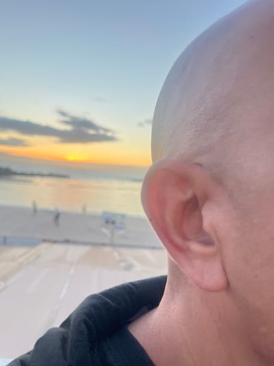 Close-up, angled view of a person's head, including a partially visible ear and the side of a bald head. The backdrop features a beach scene with an orange and yellow sunset. Blurred figures of people can be discerned on the beach. A white railing and tiled flooring are also visible in the foreground. Based on the sunset hues and beach setting, the location is likely within the municipality of Mogán, Spain, known for its coastal areas.