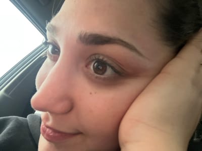 A close-up image depicts the right side of a female individual's face within what appears to be a vehicle interior. Her brown right eye is fully visible, with defined eyebrows and eyelashes. A small dark mole is present on her right cheek below the outer corner of the eye. Her nose is seen in profile, and her lips, partially visible in the lower left, show a light pink or peach color. Her right hand, adorned with a ring on the ring finger, is positioned against the right side of her face. The background is out of focus, revealing a bright, overcast sky through a window in the upper left and a dark internal structure, likely a car door panel. The specific location in Lonate Pozzolo, Italy, is not visually ascertainable from the image.