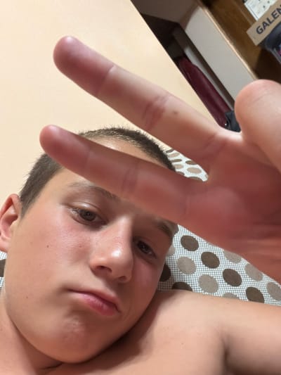 The image shows a close-up of a young person's face as they hold their hand up, obscuring part of the frame and forming a peace sign. The person is looking towards the camera with their eyes open. Their skin appears flushed, and there are some subtle blemishes visible. The background includes a patterned surface with circles and a portion of a light-colored table or surface. In the upper left corner, a glimpse of a shelf is visible with some items, including a red object and what appears to be a label with the word "GALEN" in uppercase letters. The lighting suggests an indoor setting, possibly during the day. The overall mood conveyed is casual and playful due to the peace sign gesture. The location context provided is Sliven, Bulgaria, but no specific visual cues in the image directly confirm this.