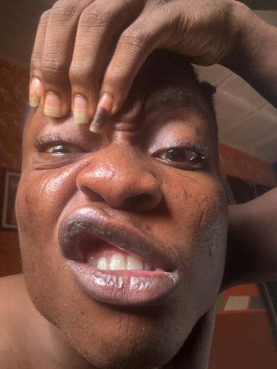 A close-up, low-angle shot captures a person's face, dominated by their mouth and eye. Their mouth is open, revealing white teeth and a shiny, pink tongue. The skin of their face appears oily. Their left eye is partially obscured by a hand pressed against the forehead. The background is out of focus, showing warm-toned walls and some indistinct objects. The lighting suggests an indoor setting, possibly a residence in Ikorodu, Nigeria, with natural light coming from the right.