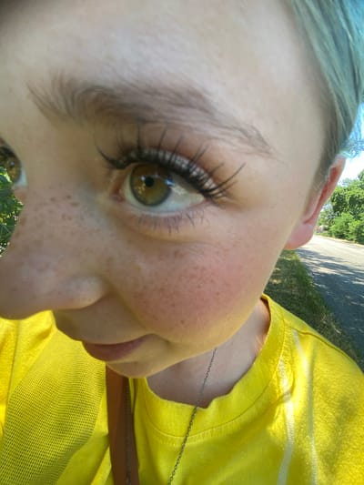 This is a close-up, wide-angle, outdoor, natural light photograph of a person's face, specifically focusing on their left eye, nose, and cheek, with the background showing a paved road and green trees. The individual has light skin with prominent freckles across their nose and cheeks. Their left eye is green with visible eyelashes and eyebrow. The person is wearing a bright yellow t-shirt and a thin silver necklace. The left side of their face is in the foreground, with the right side of their face and the background receding. The image appears to be taken at eye level. The location is identified as Nova Praha, Ukraine.