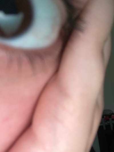This image presents a severely out-of-focus, close-up view of a human eye and surrounding facial skin, situated in the city of Saverne, France. The central subject is the lower portion of an eye, featuring a dark brown iris with a light, reflective overlay. Dark, sparse eyelashes are visible on the lower eyelid. The skin surrounding the eye is light-toned with subtle creases. A blurred, flesh-toned form, consistent with a finger or hand, partially obstructs the right side and lower area of the eye. The environment, discernible in the extremely indistinct background, consists of muted dark tones on the right, with a faint, bright, possibly reflective object situated on top of darker, undefined shapes in the bottom right corner, suggesting an indoor setting. The entire scene is characterized by profound blur, lacking any sharp detail.