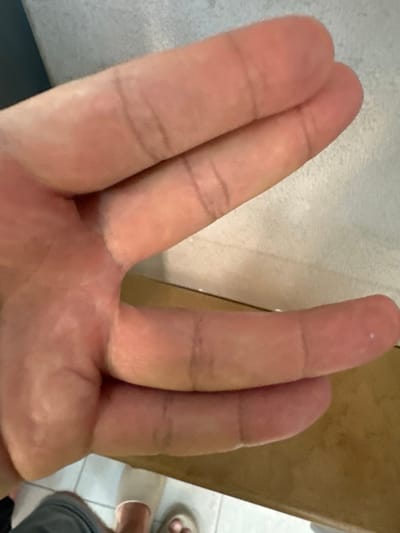 A close-up, overhead shot shows the palm and fingers of a person's hand, held over a textured, light-colored surface. The hand is positioned so that the fingers are fanned out slightly, with the index and middle fingers appearing to be held together. The skin tone is fair, and faint lines indicative of knuckles and finger joints are visible. The lighting casts soft shadows. The lower portion of the image reveals a person's legs, wearing gray shorts, and two light-colored slippers on their feet, suggesting they are indoors. The background behind the hand is a blurred, speckled surface, and a wooden countertop is visible below the hand and to the right. The scene appears to be in a residential setting within the city of Tivat, Montenegro, likely a home environment. There is a small white speck visible on the tip of the person's right index finger.
