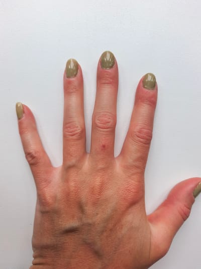 A close-up, overhead shot displays a person's left hand with olive green nail polish on the visible fingernails. The hand is positioned on a textured, white surface. The skin tone is fair, with visible veins and some minor redness around the knuckles and nail beds. A small, reddish mark is present on the back of the hand between the index and middle fingers. The thumb and index finger have nail polish on the tips. The remaining visible fingernails (middle, ring, and pinky) are also painted with the same color. The background is a plain white surface, providing no contextual information about its location in Sterlitamak, Russia.