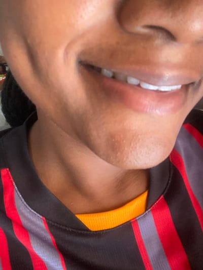 A close-up shot showcases a person's smiling face, angled downwards. The teeth are prominently displayed, appearing bright and well-aligned. The skin has a smooth texture. The person is wearing a shirt with black, red, and gray horizontal stripes. The collar of the shirt reveals an orange inner layer. A portion of the neck is visible beneath the shirt.
