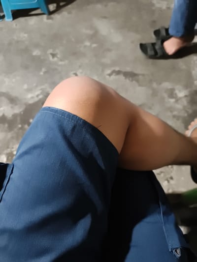 The image shows a close-up of a person's legs and knees, wearing navy blue shorts. The background is a concrete floor with some scattered debris. To the right, another person's feet wearing black sandals are visible. The scene appears to be outdoors, possibly in a casual setting. The location is not specified beyond the general vicinity.