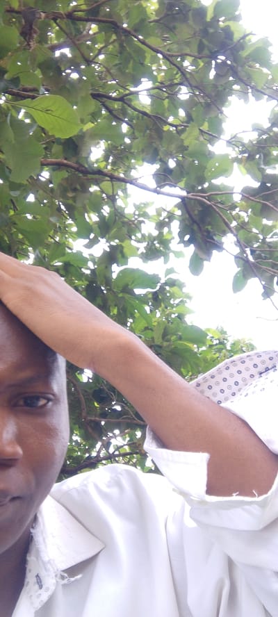 The image shows a close-up, Dutch angle shot of a dark-skinned person's face and arm, viewed from a low perspective looking up into the branches of a tree with green leaves. The person is wearing a white collared shirt with a subtle pattern of small, dark circles. The arm is bent, with the hand resting on the head. The background is dominated by the dappled light filtering through the tree canopy. This scene appears to be outdoors, possibly in a residential area or a park, given the presence of trees and the casual attire of the subject. The overall lighting suggests it is daytime, with a bright sky visible through the leaves. The composition is informal, likely a selfie or a candid shot taken by someone nearby. The specific location of Madalla, Nigeria is not visually evident from the image itself.