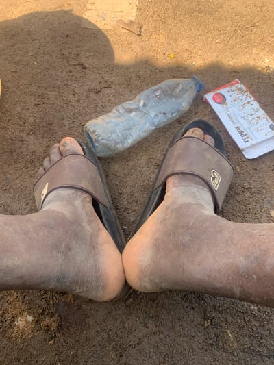 The image depicts a close-up view of a person's feet, wearing dirty brown slides, resting on muddy ground. To the left of the feet, a partially filled, crushed plastic water bottle lies on its side. To the right, a white and red box, appearing to be medication packaging, is also present on the ground. The environment is characterized by loose, damp soil, suggesting an outdoor setting, possibly in a rural or less developed area. The lighting indicates it is daytime, with a shadow cast from an unseen object in the upper left portion of the frame. The feet themselves are visibly dirty, covered in mud and dust. The medication box has text that is partially obscured but includes "Zypro" and "500mg," suggesting it contains antibiotics. The overall scene implies a moment of rest or pause in an environment where such conditions are present.