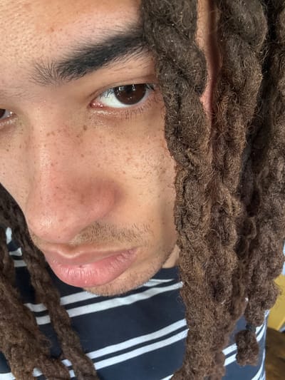 A close-up, slightly angled view of a person's face. The person has brown eyes, dark eyebrows, and light brown skin with freckles. They have brown dreadlocks framing their face. The background is a black and white striped fabric. It is not possible to determine the location as Les Ulis, France from the provided image.