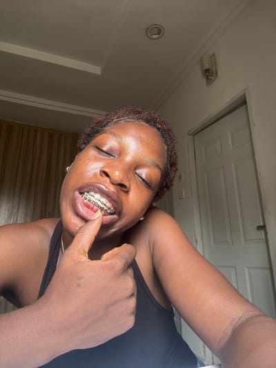 A young African woman with brown, tightly curled hair, dark skin, and braces on her teeth is visible in an upward-angled close-up shot. She has her eyes closed and her finger is touching her braces. She's wearing a black tank top. A partially visible hand is positioned near her face. The background includes a white ceiling with a square access panel and an old-fashioned light fixture. Based on the prompt, this scene is possibly located in Lugbe, Nigeria.