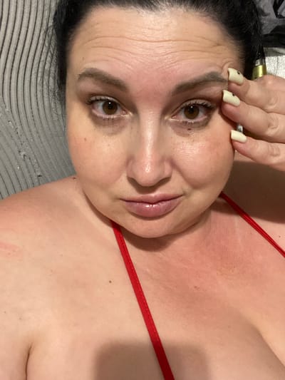 The image shows a close-up selfie of a woman's face and upper chest. She has dark hair pulled back, brown eyes, and is wearing a red bikini top. Her skin appears red, suggesting sunburn. Her right hand is touching her forehead. The background on the left is a textured gray surface, possibly a wall or furniture. There is no discernible urban environment or specific location in Rozkvit, Ukraine.