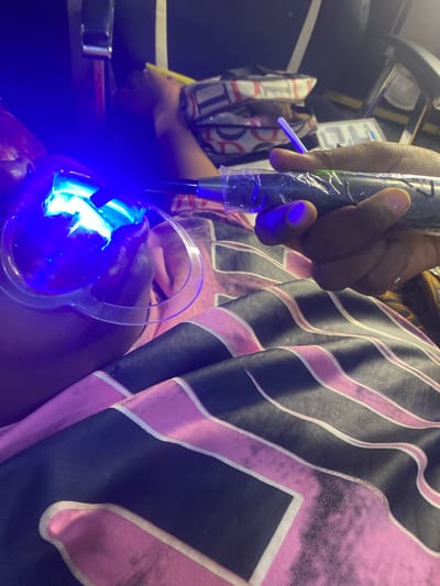 In an indoor setting, possibly a home or salon, a person's head is tilted back, and their mouth is open, illuminated by a bright blue light. A clear, heart-shaped dental retractor is in place, keeping the mouth open. A hand is holding a device with a blue light emitting from its tip, positioned directly into the mouth. This device appears to be a professional teeth whitening light. The person is wearing a pink and black striped garment, and a bag with a patterned design is visible in the background, along with what looks like a chair. The overall scene suggests a teeth whitening procedure is underway. The specific location within Unknown, Nigeria, cannot be determined from the image alone.