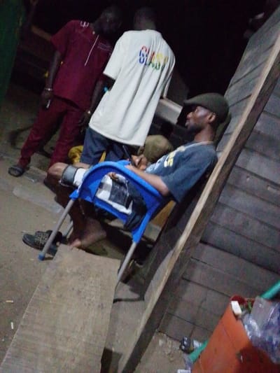 A person with a leg injury, supported by a leg cast, sits in a blue plastic chair. He wears a dark shirt, dark trousers and a cap. Two other individuals stand in the background. One wears a red suit, and the other has on a white t-shirt. The scene is dimly lit, and the environment is a construction site. A piece of plywood lies on the ground near the person in the chair.