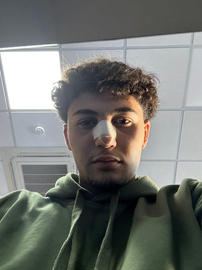 A young male individual is depicted in a close-up, upward-angled shot within an indoor environment in Jibb as-Safa, Syria. He has dark, curly hair and light facial stubble. A white medical bandage is applied to the bridge and tip of his nose. He wears a dark green hooded sweatshirt and maintains a direct, neutral gaze towards the camera. The background consists of a white suspended ceiling with a grid pattern, featuring square LED light panels, one of which is brightly lit. An air conditioning cassette unit with a white grille and a red circular fire alarm detector are visible on the left side of the frame.