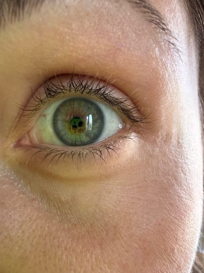 The image is a close-up, eye-level, detailed shot of a human eye. The iris is a striking shade of green with flecks of blue and yellow, and the pupil appears black and round. The reflection in the pupil is not clear, but it seems to show a green object with black circular markings. The eye is surrounded by pale skin with visible pores and fine hairs. The eyelashes are dark and long. The upper eyelid is partially visible, with a hint of darker hair that could be from an eyebrow. The lighting is soft, highlighting the textures of the skin and the details of the eye. There is no indication of any specific location in Tvarditsa, Bulgaria, or any environmental context beyond the human subject. The image focuses solely on the eye and surrounding facial features.