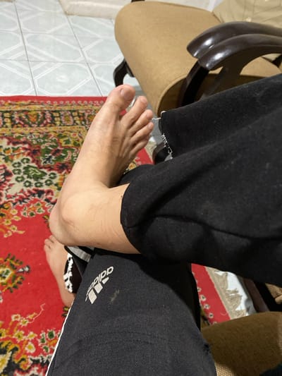 The image shows a close-up, downward-angled view of a seated individual's lower extremities in an indoor environment in Ciputri, Indonesia. A bare human left foot, exhibiting natural skin tone and light hair, is resting across the subject's right upper thigh. The right leg is clad in black athletic trousers with a white Adidas logo on the left upper thigh and a partial white vertical stripe on the lateral side of the lower leg. White frayed threads are visible at the hem or a tear on the left pant leg. The floor is covered by a patterned red rug with multi-colored designs on the left and light-colored square ceramic tiles on the right. A light brown upholstered chair with dark wooden armrests and a portion of a cream-colored upholstered furniture item are visible in the background.