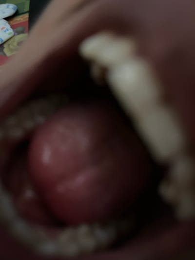 The image shows a close-up, out-of-focus view inside an open mouth. A large, pink, bulbous object, likely a tongue, is the central focus. Several teeth, appearing yellowish and uneven, are visible along the edges of the mouth, suggesting they are the upper and lower molars. The lighting is dim, creating shadows and obscuring fine details. The background is dark and indistinct. There is no discernible information about a location in Benuaraja, Indonesia, or any other specific environmental details.