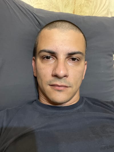 A close-up, overhead selfie of a bald man lying on a gray pillow, with a patterned, light-colored surface behind him. He is wearing a dark gray t-shirt. The man's eyes are open and he is looking directly at the camera. His skin appears slightly oily. The background indicates an indoor setting, likely a bedroom. There is no discernible indication of the city of Kalininets, Russia, within the image itself.