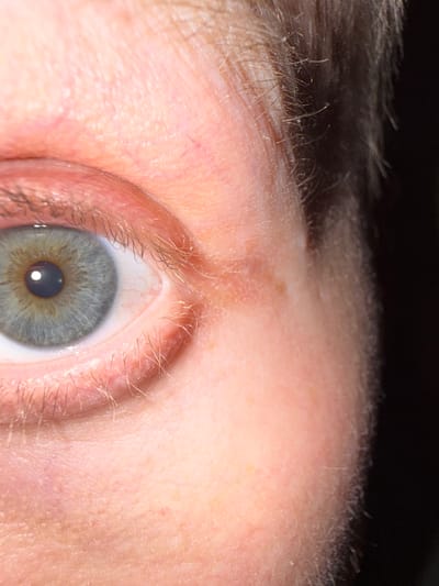This close-up image captures the right human eye and adjacent facial features, located in Лабжанскі сельскі Савет, Belarus. The iris exhibits a desaturated blue-green coloration with a complex pattern of lighter radial striations near the pupil and darker concentric rings towards the limbus. The pupil is black and reflects a distinct, small, circular light source in its upper-left quadrant. The visible sclera is white with several fine, red capillaries present, particularly towards the inner canthus. The upper and lower eyelids are visible, featuring light brown to blond eyelashes, some appearing fine and sparse. The surrounding skin is fair-toned, exhibiting fine vellus hair, visible pores, and subtle variations in texture. Minor reddish capillary lines are discernible on the upper eyelid and cheek area. Darker, coarser head or eyebrow hair is present along the right edge of the frame, contrasting with the lighter vellus hair on the skin. Illumination appears direct and even on the facial surface.