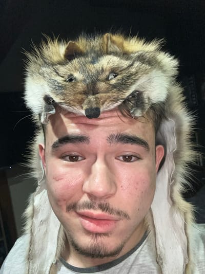A young adult male is depicted in a close-up, chest-up portrait against a dark, undifferentiated background. He has a light skin tone, dark hair, dark eyebrows, a mustache, and a short goatee. A visible scar is present on his left cheek. He is wearing a light-colored t-shirt. The male subject is wearing a hat constructed from an animal pelt, featuring the head of a canid, likely a fox, positioned centrally on his forehead. The animal's head displays artificial eyes and a black nose. The fur, a mix of brown, tan, and cream, drapes over the sides of his head and shoulders, with the lighter underside of the pelt visible. The subject is looking directly at the viewer with a neutral to slightly smiling expression. The specific location within Voluyak, Bulgaria, is not discernible from the visual evidence.