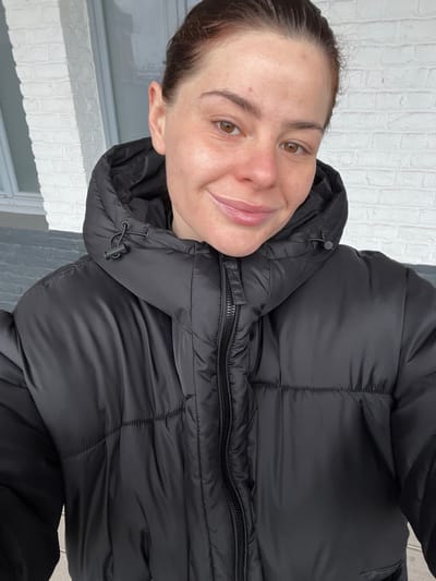 A medium close-up photograph depicts an individual, appearing to be an adult female, situated outdoors in the city of Roubaix, France. The subject is positioned facing forward, looking directly into the camera with a subtle upward curve of the lips. Her dark brown hair is pulled back, revealing her ears. Her complexion is fair, exhibiting minor localized redness and small blemishes on the forehead, nose, and cheeks. She possesses brown eyes and glossy lips. The individual is dressed in a black, hooded puffer jacket, which is partially zipped up. The jacket features horizontal baffle stitching and a visible black zipper. A black plastic drawstring toggle is present on the right side of the jacket's hood. The background consists of a white brick wall, with a dark gray horizontal ledge or railing visible below it. A light-colored vertical structure, consistent with a window or door frame, is partially visible on the left side of the frame.