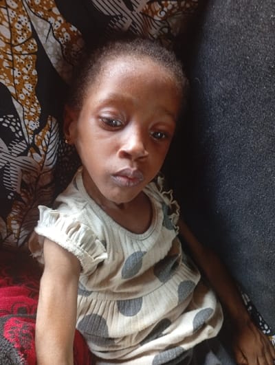 A young, dark-skinned child with a serious expression looks at the camera. They wear a light-colored dress with dark polka dots and ruffled sleeves. An earring is visible in their left ear. The child is seated, and the background includes a dark-colored wall or fabric to the right, and a patterned fabric to the left, with a red blanket below. The child appears frail, with thin arms.