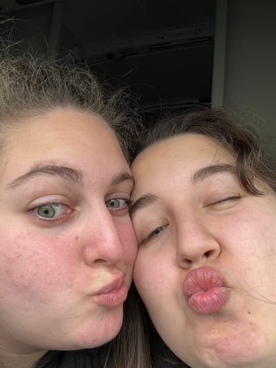 The image displays a close-up portrait of two female individuals, appearing to be young adults, positioned intimately cheek-to-cheek. The individual on the left side of the frame has fair skin exhibiting general redness on the cheeks and nose, light green-blue eyes that are wide open and directed towards the viewer, and light-colored, disheveled hair. Her lips are pursed in a slight pouting expression. A small, dark mole is present on her left cheek, below the eye. The individual on the right side of the frame has fair skin with visible pores and minor blemishes, dark brown wavy hair, and her right eye is closed in a wink while her lips are formed into a more pronounced pout. Both individuals have natural eyebrows and appear to be wearing dark-colored clothing, partially visible at the bottom edge of the frame. The background is dark and out of focus, showing only vague, indeterminate structural elements in the upper portion, consistent with an indoor environment. There are no visual elements within the image to ascertain its specific location within the city of Breda, Netherlands, or any other geographical area.