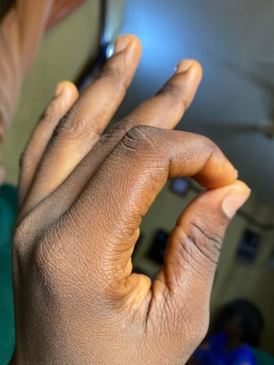 A close-up image of a dark-skinned human hand is depicted, with the index finger and thumb touching to form a circle. The other three fingers are extended. The skin texture is visible, revealing wrinkles and pores. The background is blurred, showing indistinct objects and colors. It is not possible to determine the location or any information about Nsukka, Nigeria.