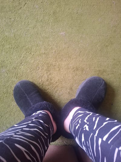 The image shows a person's legs and feet, wearing black and white zebra-striped leggings and black suede slippers lined with fur. The legs are positioned on a green, carpeted surface. The setting appears to be indoors, likely a residential space, in the city of Naucalpan de Juárez, Mexico. No other people or objects are visible.