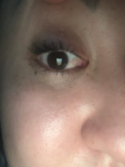 The image is a close-up, slightly blurry shot of a person's right eye, showing eyelashes, iris, and sclera. The surrounding skin is visible, with some minor imperfections. There is a distinct reflection in the iris, suggesting a light source. The overall tone is warm. The image does not provide any information or context related to the city of Phú Quốc, Vietnam, or any urban environment. It is a purely facial close-up.