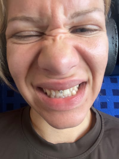 The image shows a close-up of a person's face, focused on their mouth and eyes. The person is wincing or making a strained expression, with their eyes squinted shut and their mouth open, revealing their teeth. A small metallic stud is visible on one of their front teeth. The person is wearing headphones, with the right earcup visible behind their head. They are also wearing a dark-colored shirt. The background consists of a blue surface with a grid pattern, suggestive of a seat in a vehicle. The image does not provide any specific visual clues to determine the exact location within Ampfing, Germany.