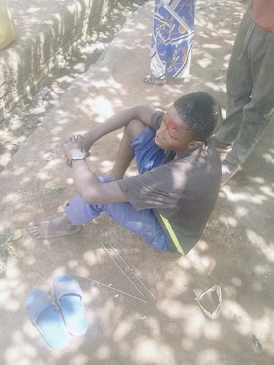 The image depicts an outdoor scene in Kwekwe, Zimbabwe. The precise location within the city is not discernible from visual evidence. In the foreground, a young male individual, appearing to be a teenager, with dark skin and short dark hair, is seated on compacted dirt ground. He wears a dark short-sleeved t-shirt with a vertical neon green stripe on its left side and blue trousers. He is barefoot, with his knees drawn up towards his chest and his hands clasped over them. A visible laceration with dried blood is present on his forehead, superior to his left eye. A silver-colored watch or bracelet is on his left wrist.
To the left of the seated individual, a pair of light blue slide sandals rests on the ground. Three thin, straight metallic rods are positioned on the ground between the sandals and the seated male. To the right of these rods, a light-colored, possibly fabric or leather, object resembling a sling or catapult pouch lies on the dirt.
Two other individuals are partially visible in the background, standing. One person on the far left wears a long, blue patterned skirt or dress with white and gold designs and dark open-toed footwear. Another person on the right, positioned closer to the seated male, wears light-colored trousers and dark footwear, with their left leg visible.
The ground surface consists of unpaved dirt or sandy earth. Dappled shadows, consistent with overhead foliage or structures, are cast across the scene, indicating an outdoor, sunlit environment. In the far left background, a low, rough-textured earth or concrete embankment is visible. The scene suggests an outdoor, potentially residential or semi-urban setting.