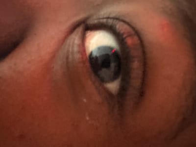 A close-up shot shows a human eye, predominantly blue, with a red reflection visible on the iris. The surrounding skin appears to be of a tan complexion. Eyelashes are visible. The image lacks sufficient context to determine the location in Pretoria, South Africa.