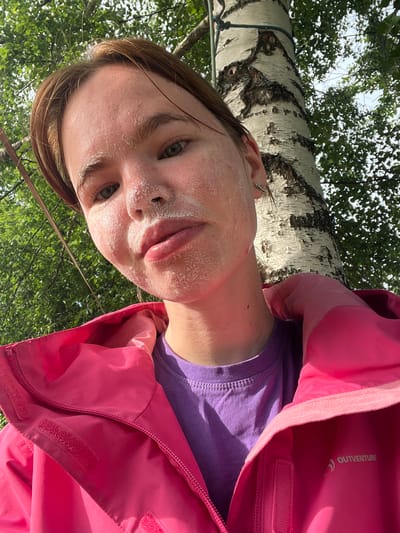 A low-angle, close-up selfie features a person wearing a bright pink jacket over a purple t-shirt. The person's face is tilted upwards, with a portion of a birch tree trunk visible in the background, along with lush green foliage and a bright sky. The person's skin appears flushed and has white patches, possibly from sunscreen or a rash. Their eyes are open and looking towards the camera, and their lips are slightly parted. A small, silver earring is visible in their right ear. The lighting suggests it is daytime, likely sunny, given the shadows and highlights. The text "OUTVENTURE" is visible in white lettering on the inside of the pink jacket. The scene appears to be outdoors, possibly in a wooded or park-like area, consistent with a location in Sergino, Russia. The overall impression is of a casual, outdoor snapshot, perhaps taken during a recreational activity.
