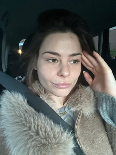 An adult female is depicted from the mid-torso up, seated inside a vehicle, likely a car. She has light brown hair, brown eyes, and a fair complexion, with a visible blemish on her forehead. Her lips appear slightly parted with a glossy finish, and she displays a subtle smirk or pout. Her gaze is directed towards the viewer's right. She is wearing a light-colored, possibly beige, furry or faux fur vest over a gray knitted garment. A dark seatbelt crosses diagonally from her left shoulder to her right hip. Her left hand is raised, with fingers splayed, and rests against her left temple/forehead area. The vehicle's interior appears dark. Through the windows in the blurred background, a distant light source and faint indications of an outdoor environment are visible. The specific location within Villeneuve-d'Ascq, France, cannot be determined from the visual information provided in the image.
