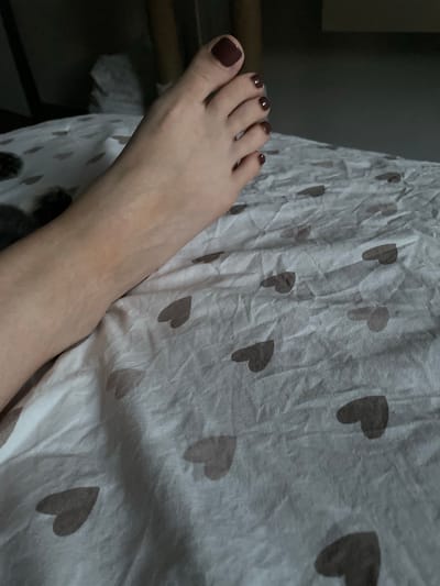 A person's foot, with dark red nail polish on the toenails, rests on a white bedsheet patterned with grey hearts. The foot is positioned from the ankle to the toes, with the toes slightly curled. The skin of the foot and lower leg is visible, showing veins and some discoloration. The background is dark and out of focus, with hints of a wooden object and some crumpled white material. The scene appears to be indoors, likely in a bedroom. This image was taken in Monastyrskoe, Russia.