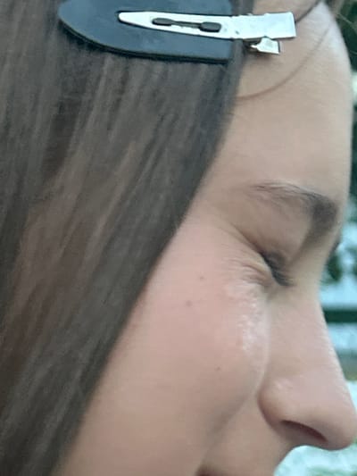 A close-up, profile view of a person's face is captured, focusing on the right side of their face. The individual has dark hair, part of which is visible on the left side of the frame, held in place by a black hair clip with a silver accent. The person's right eye is visible, with a dark eyebrow. The bridge of the nose and part of the nostril are also in focus. The skin tone appears fair, with subtle texture and a few small blemishes. The background is blurred, suggesting an outdoor setting with green foliage. The image does not provide any information to determine its location in the city of Tiraspol, Moldova.