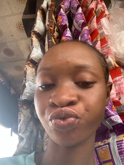 The media file features a close-up, overhead shot of a person's face, tilted at an angle, positioned in front of a collection of snack bags. The person's eyes are partially closed, and their lips are slightly pursed, conveying a relaxed or playful expression. The skin tone is dark, and there are faint blemishes visible on the forehead and cheek.
The background is dominated by stacks of brightly colored snack packaging, primarily in shades of purple, red, and brown. Visible text on the packaging includes nutritional information, ingredient lists, and brand names. Some of the legible text indicates "MAX", "Chinchin", "INFINITY SNACKS", "Ingredients: Wheat Flour, Sugar, Salt, Margarine, Vegetable Oil", and "Nutritional Information" with calorie counts and other dietary details. The packaging appears to be from a local market or vendor in Shagamu, Nigeria, given the context. The lighting suggests it's daytime, with shadows indicating artificial or diffused light. The overall scene depicts a casual moment, possibly at a market stall, with the person interacting with or posing near the displayed snacks.