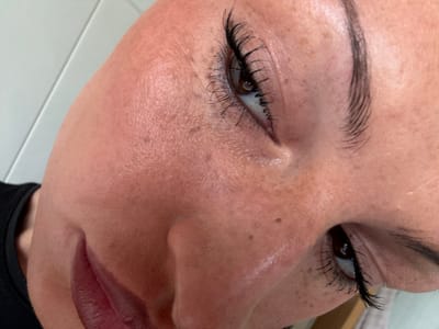 A close-up, angled view of a person's face. The individual has brown eyes and dark eyelashes, likely enhanced with mascara. Their skin tone is light with freckles and two prominent moles near the nose. Their lips are visible, with a dark lipstick or lip stain. Part of their eyebrow is visible. To the side, a portion of a black garment is visible, and a glimpse of a white surface is present in the lower right corner. The photo does not provide information about Wealden, United Kingdom.