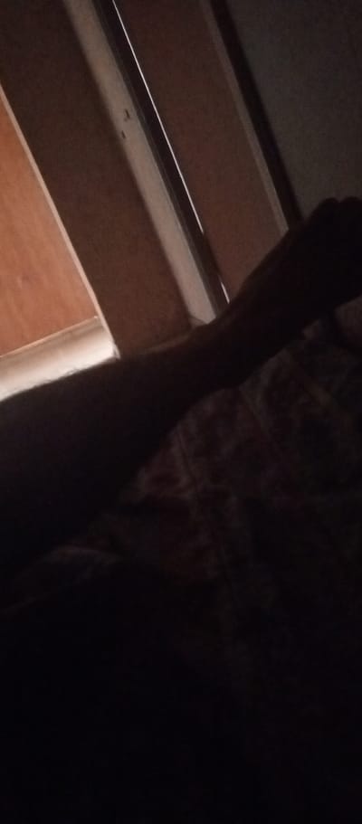 The image shows a close-up, dimly lit view of a person's arm and hand, resting on a patterned surface. The arm is dark and appears to be resting at an angle. The background is out of focus and appears to be a wall with some wooden elements. There are no visible landmarks or clues to indicate the location is Lyubertsy, Russia.