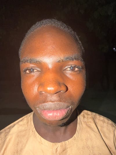 A close-up, wide-angle image captures a single male individual with dark skin, centered against an undifferentiated dark background. The subject appears to be a young adult, presenting a direct, neutral gaze into the camera. His short, dark, curly hair is visible, with a defined hairline. Distinct features include dark, full eyebrows, brown eyes with visible eyelashes, a broad nose, and full, light pinkish-red lips that show some texture. Harsh, direct frontal lighting illuminates the face, creating prominent highlights on the forehead, nose, and lips. The individual wears a light tan or brown garment, possibly a traditional tunic, featuring subtle, embossed or woven geometric patterns and a buttoned placket at the neck. The scene is located in Gandu Albasa, Nigeria. No other persons or significant objects are discernible.