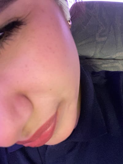 A close-up, slightly angled view of a person's face. The focus is on the forehead, nose, and part of an eye with visible eyelashes. Reddish lipstick is visible. The person's skin is light-toned and marked with small dots. A dark-colored, textured fabric is visible to the right, and a grey textured material is seen on the left. The location of the image is unknown, so it cannot be determined if it is in El Dátil, Venezuela.