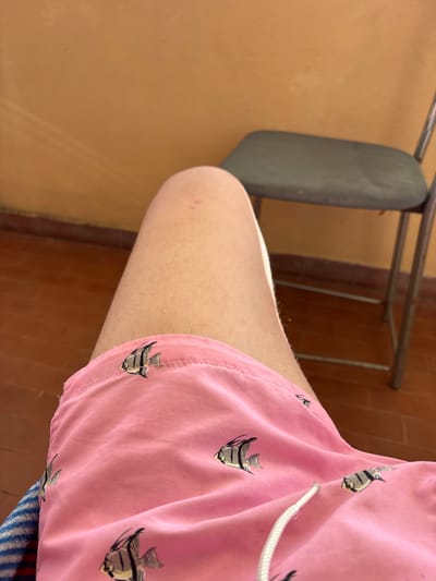 The image shows a close-up, high-angle view of a person's upper leg and pink shorts, against a blurred background. The primary subject is a fair-skinned leg with visible fine hair, and a small red mark or bump on the upper thigh. The leg is mostly obscured by a pair of bright pink swim shorts or casual shorts.
The shorts feature a repeating pattern of stylized fish, which are predominantly black, white/grey, and yellow. A white drawstring is visible on the front of the shorts. The fabric of the shorts shows some creases and stitching lines.
In the background, a dark grey or dark green chair back and part of its metal frame are visible. The floor appears to be covered with reddish-brown tiles, and a light brown or tan wall or surface is also present. The lighting is bright, suggesting daytime. No specific activity is clearly depicted, other than the person appearing to be seated. There is no visible text in the image. The location context is Ardea, Italy.