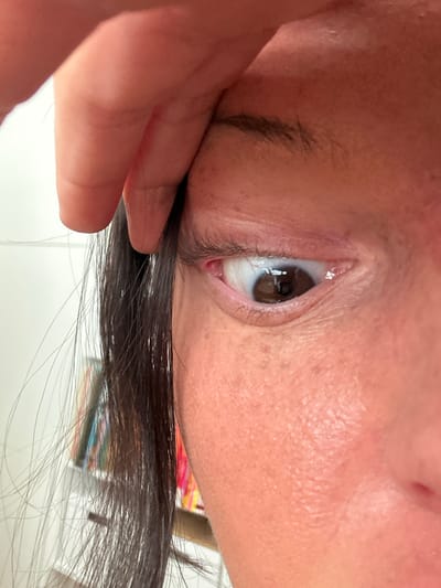 The image shows a close-up of a person's eye. The eye is brown, and the person's skin is light-skinned. Some hair strands are visible in the lower portion of the frame. A finger is holding the hair up. There is no information in the image to relate it to the city of Wealden, United Kingdom.