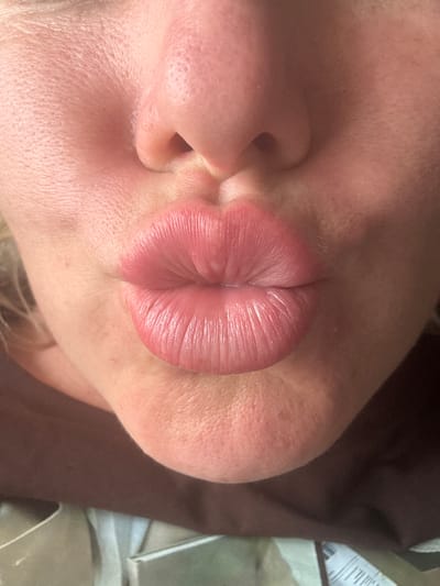 This is a close-up, rotated image focused on the mouth and nose area of a person. The person's lips are pursed, creating deep vertical creases, and are a vibrant pinkish-red color. The skin around the mouth and nose appears to be fair-skinned with visible pores and some very fine, light-colored hairs on the upper lip area. The nostril is also visible. The lighting suggests it is indoors, possibly artificial light given the evenness and slightly warm tone. The background is blurred and dark, with a hint of a textured surface and some faint white text on a light-colored object visible in the upper right corner, but it is illegible. No specific time of day, weather, or explicit emotions are conveyed beyond the action of pursing the lips. The location context of Pozdyshki, Russia, is provided but not visually discernible from the image itself.