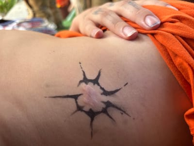 A close-up image taken in Pai, Thailand, focuses on a section of human skin, likely an upper arm or shoulder. Centrally positioned is a raised, pinkish-white scar, approximately 2-3 cm in diameter, around which an abstract, black ink tattoo has been applied. The tattoo design features irregular, jagged points extending outwards, creating a sunburst or star-like pattern that integrates the scar into its composition. In the upper right quadrant, a hand with visible fingernails and faint knuckle tattoos rests on the skin, partially covered by bright orange fabric, likely a garment. The background is out of focus, showing blurred shapes and colors indicative of an informal outdoor or well-lit indoor setting.