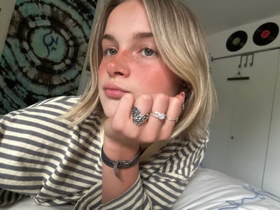 A rotated selfie shows a person with fair skin, blonde hair, and grey eyes. The person has freckles on their nose and cheeks. They are wearing several rings on their fingers and a leather bracelet on their wrist. They are wearing a striped shirt. The background includes a record player, a tie-dye patterned fabric, and a white sheet. There is no evidence to suggest the location is Whistler, Canada.