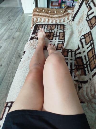 The image shows a person's legs from the knees down, resting on a blanket with a brown and white geometric pattern. The person is wearing black shorts. The left leg appears to be tanned, while the right leg is lighter in color. The background shows a wooden floor and what looks like part of a closet or cabinet. The scene is indoors, likely a home in Krasny Gulyai, Russia. There is no text visible in the image.