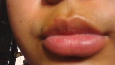 The image is a close-up of a person's lips and surrounding skin. The lips are full and pink, with some subtle highlights indicating a slight sheen, possibly from lip balm or gloss. There is a small mole visible on the left side of the face, above the lip. The skin tone appears to be warm, with some variations in shading. The background is blurred and dark, with hints of vertical lines that could suggest the presence of blinds or a similar textured surface. The image is an extreme close-up and does not contain any information about a city or location.